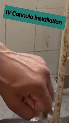 💉 “Cannula Installation Step-by-Step | Safe IV Insertion Tutorial” #youtubeindia #medical