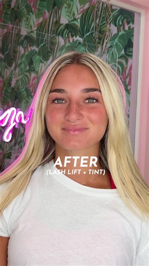 Lash lift & tint on this beauty 💗 What is a LL&T? A lash lift is essentially a perm for your eyelashes — a solution is applied to each individual lash to create the curled effect, lifting your lashes from the root to create a more awake, freshly fanned out look. Once the lashes are curled, we then apply lash tint — think of it like semi-permanent mascara that will make each lash look thicker and longer. Who is a candidate for an LL&T? 1. Anyone that is allergic to eyelash extension adhesive, th