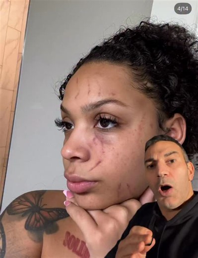 Joseph Robert 🏈 on Instagram: "I’m not shocked at all by these allegations. Coming from Rashee Rice — the same player involved in an hit-and-run that reportedly caused injuries — this raises serious questions. His ex Dacoda Nichole has now come forward with detailed allegations of abuse and control, backed by photos she shared publicly. They were together for 8 years! These are allegations, but ignoring them because someone plays football is how people get protected when they shouldn’t be. If t