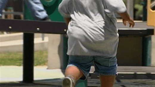 New study shows severe obesity is increasing among kids in the US