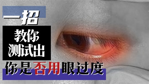 如何判断自己用眼过度？一招教你get明亮双眼~