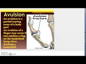 Types of Soft Tissue Injuries