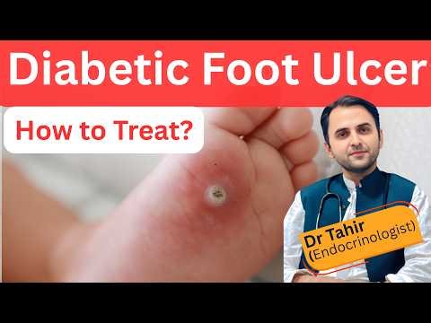 How to Treat Diabetic Foot Ulcer, Early Signs, Causes, Types & Treatment