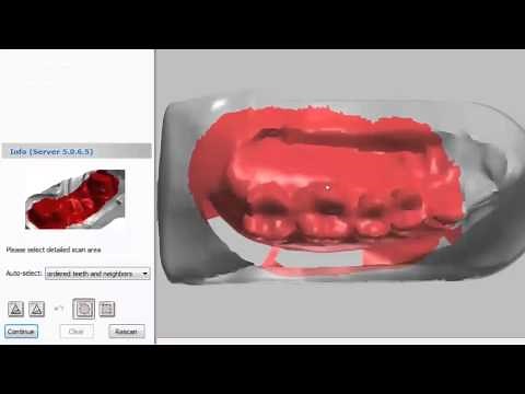 3Shape Tutorial - Scanning Anatomical Copings, Changing Scan Settings, and Achieving Accurate Scans