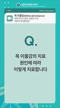 [목 이물감] 목 이물감의 치료, 원인에따라 이렇게 치료합니다