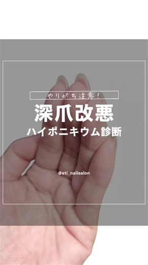 ハイポニキウムの重要性と正しいケア方法を解説