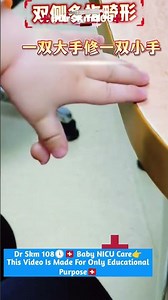 “Baby Born with 6 Fingers 😲 Rare Condition Explained#godblessyou#newbornbaby#birthmoment#viralshort