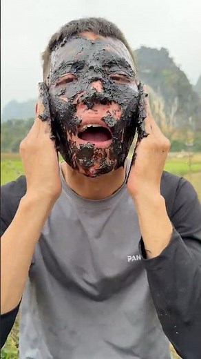 How I Used Cow Manure to Treat Acne in the Wild | Survival Story”