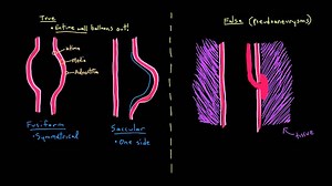 Thoracic aortic aneurysms
