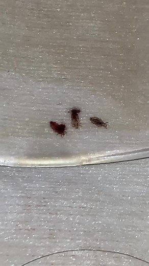 Ur first @ has lice !!! #licetok #licepopping #cometoworkwithme #halaraeveryday #halaradress