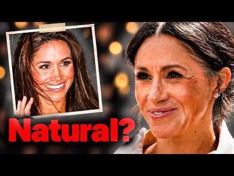 12 Meghan Markle Plastic Surgery Rumors — True Or Not