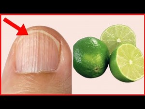 Top 3 Natural Home Remedies for Black Lines on Nails| How to get rid of ridges in fingernails