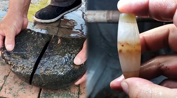 Advanced Innovation and Expert Hands Achieving Flawless Results