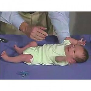 THE MORO (STARTLE) REFLEX #MindfulMonday Notice how this infant has a sudden splaying of it’s arms when it experiences a sudden sensation of falling. This is described as the ‘Moro reflex’ - a normal primitive, infantile reflex. It’s an involuntary protective motor response against abrupt disruption of body balance or extremely sudden stimulation. Loud noises, intense light, & sudden movements can trigger a baby’s Moro reflex. They can even trigger it in themselves when they move suddenly! It is