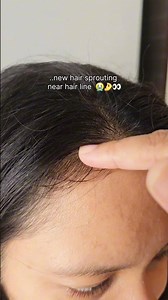 *HONEST* Hair Growth Serum review| I'm amazed by the results 👀💙✨️🤌 #youtubeshorts #fyp #trendingnow