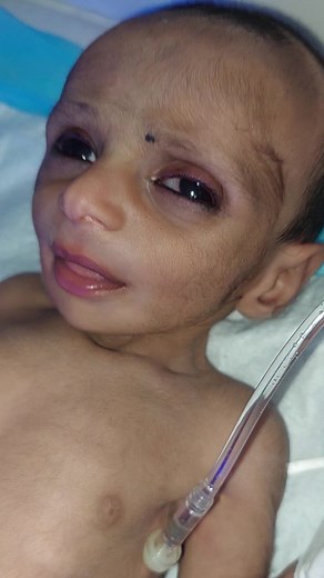 1.8M views · 58K reactions | Please do not feed goat and cow milk to newborn baby #Ftt #loose #motion #Dehydration #newborn #baby #bornbaby #babygirl #babiesworld #feed #2023春婚 #infant Hidden medical lifehack Enfamil | Hidden medical lifehack | Facebook