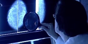 Best Life: Removing cancer without a stitch