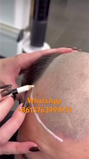 Are you struggling with hair loss? Have you tried a toupee?😍Be more confident with Lyrical Toupee!