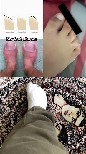 Among us (3 Collabs)