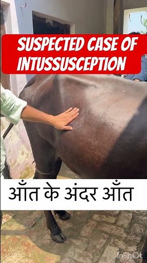 Diagnosis of Intussusception l dr Umar khan