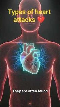 Types of Heart Attacks — Step by Step | 3D Medical Animation