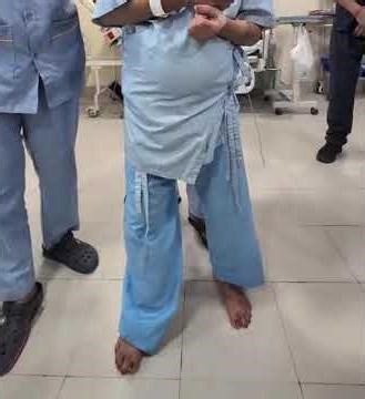 NPH gait (shuffling, wide-based, slow, short-stepped walk with Ataxia)