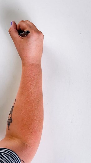 12K views | INTRODUCING… Tirzepatide Tablets The next-gen GLP-1 weight loss solution — now in an easy daily pill. No needles. No clinics. Just real results. ✨ Users report losing 11.2 lbs in 30 days  Daily tablet — no injections required 綾 Reduces hunger + improves blood sugar  Delivered fast & discreet to your door  100% online access — skip the doctor’s office Tap below to check eligibility in under 60 seconds | SkinnyRx | Facebook