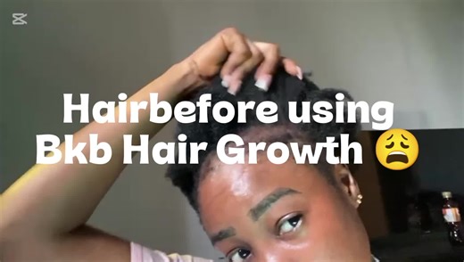 Hair Growth Tips for Men: Enhance Your Lock's Health