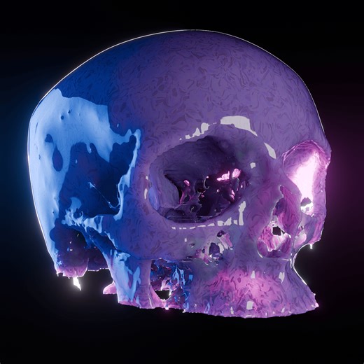 Technical-Pipeline-for-Visualizing-Medical-Imaging-Data