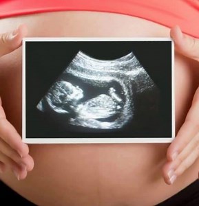 1.9K views · 4 comments | From 6 weeks to 36+ weeks, Clearview Ultrasound has something to offer everyone that is expecting! Come see your little one at the only 3D Imaging Facility in Austin Texas to offer HD technology! Congratulations! Hope to see you soon! www.ClearviewUltrasound.com 512-834-2229 | ClearviewUltrasound | Facebook