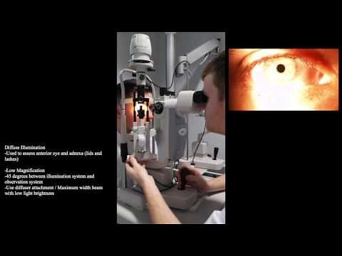 Slit Lamp: Diffuse Illumination and Patient Set Up