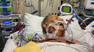 Hepatitis C is now curable but eliminating the disease from Australia comes with large challenges