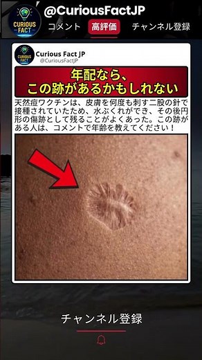 この傷跡には歴史が刻まれている