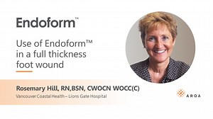 Endoform™ Case Study Full Thickness Wound