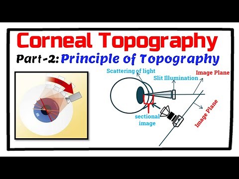 Corneal Topography: Principles of Videokeratography(VKG), Keratoscope & Keratometer.