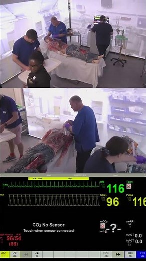 Anaesthetics Simulation – Burns Airway Emergency with Front of Neck Access FONA