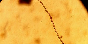 Under the Microscope