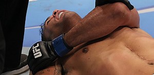 Sherdog’s Top 10: Worst UFC Injuries - No. 9