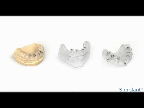 How to Use Simplant Guide?