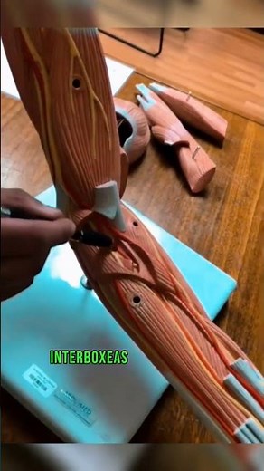 Arteries of the ARM #arteries #arm #anatomy #medicine #health