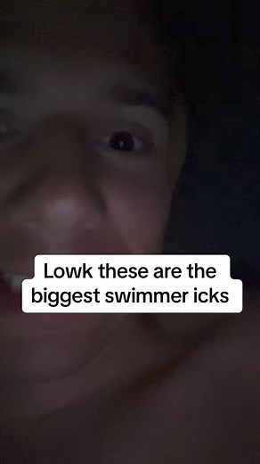 Biggest swimmer icks💧😵‍💫 📸: @swimoutlet @sportiswim •••••#swimming #swimmer #swim #swimmingpool #swimpractice #swimlife #swimmemes #swimmers #swimteam #swimmerslife #triathlete #swimcoach #swimmeet #swimmerproblems #swimmingmemes #swimbikerun #swimclub #triathlon #backstroke #swimminglife #freestyle #butterfly #competitiveswimmer #breaststroke #swimproblems #pool #swimmermemes #swimtraining #competitiveswimming #swimmingclass | SwimOutlet.com