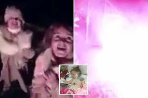 Horrifying moment girl, 4, suffers serious burns after firework explodes in her face