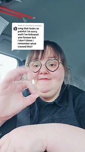 Everytime I post about my scars someone asks how it happened. Its a long story. I even left out part of it in this video. Years before homelessness I had a 3rd degree sunburn that healed. So the bites I talked about were on top of the scar tissue and it reopened it. Whew. What a journey! #healing #recovery #woundcare | Sarah Jumper