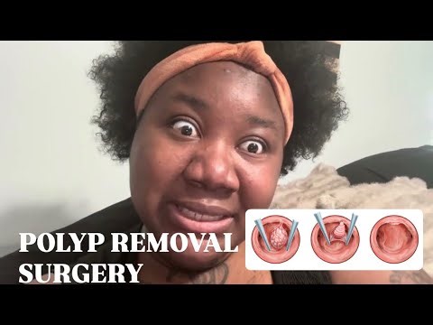 I GOT A POLYP REMOVED TODAY! HYSTEROSCOPY SURGERY