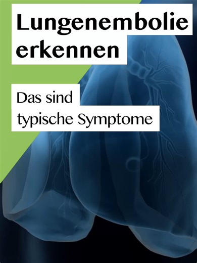 Wusstest du, was hinter dem Begriff Lungenembolie steckt? Dabei handelt es sich meist um einen lebensbedrohlichen Verschluss eines Lungengefäßes durch ein Blutgerinnsel. Da die Symptome oft unspezifisch sind, bleibt sie jedoch manchmal unerkannt. Welche Warnzeichen du kennen solltest, erfährst du im Video. #lunge #thrombose #medizinwissen #gesundheit #catherineohara