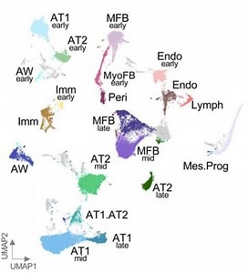Researchers Map Lung Development After Birth Into Late Childhood for the First Time | Newswise