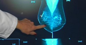 Breast density awareness is key in early cancer detection