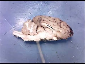 Sheep Brain Midsagittal View