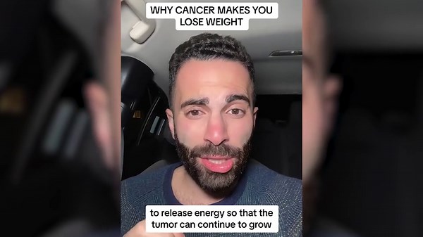 24-year-old woman diagnosed with stage 3 colon cancer after dismissing this one key symptom