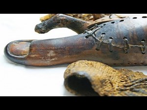 予想以上に進んでいた 古代エジプトの医学力が凄い!